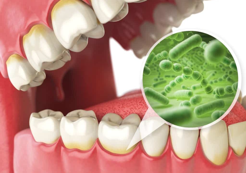 dry mouth causes remedies