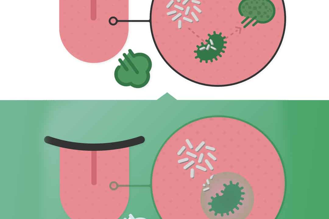 antibacterial mouthwash