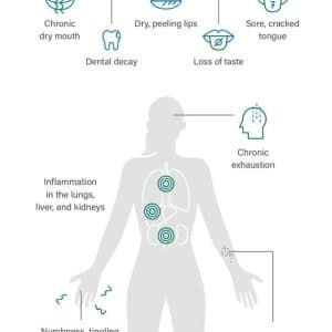 is-an-autoimmune-disease-causing-your-dry-mouth-embed Is an Autoimmune Disease Causing Your Dry Mouth?