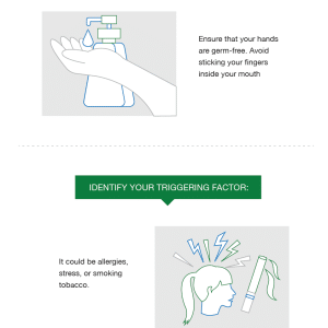 Why is the Roof of Your Mouth Sore-embed Why is the Roof of Your Mouth Sore embed